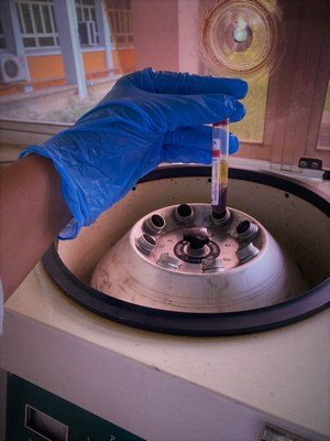 Covid PCR testing at the Department of Microbiology