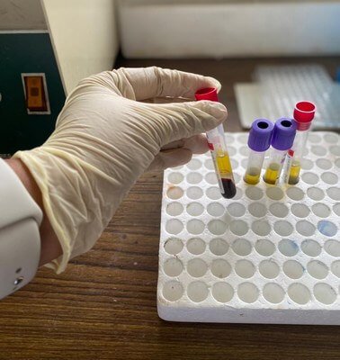 Processing Samples of Ongoing Researches