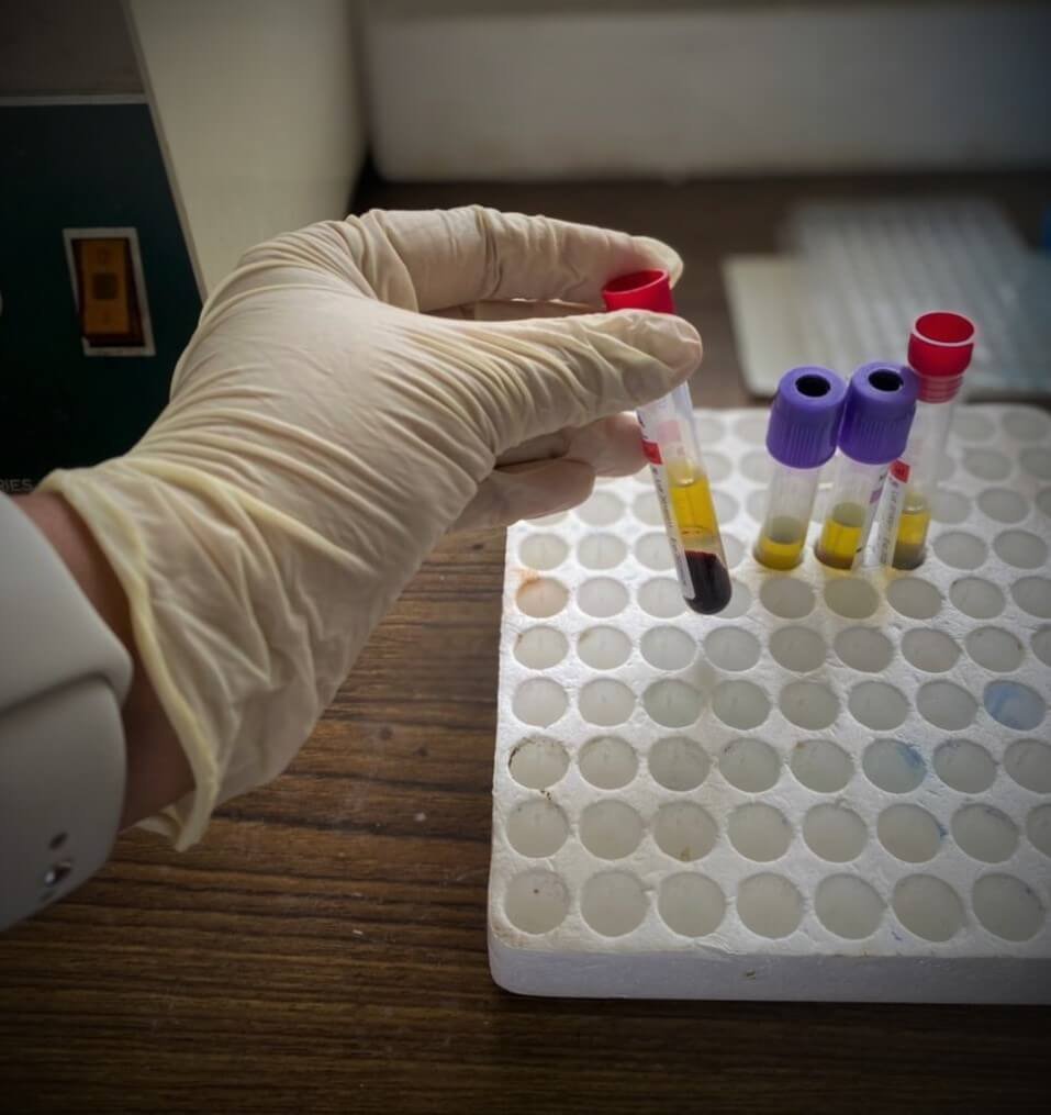 Surveillance for Emerging Infectious Diseases Among Children and Adults in the Community and Hospital Settings in Southern Province, Sri Lanka: A Cross-Sectional Study